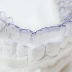 how-invisalign-works