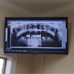 How often should I get dental x-ray - shreveport's dentist